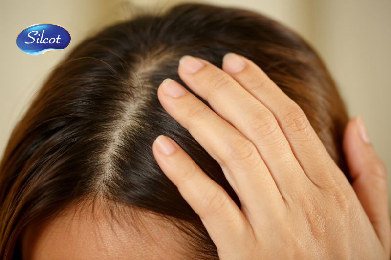 Cách sử dụng dầu gội trị vẩy nến da đầu đúng cách